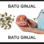 5 Catatan Obat Herbal